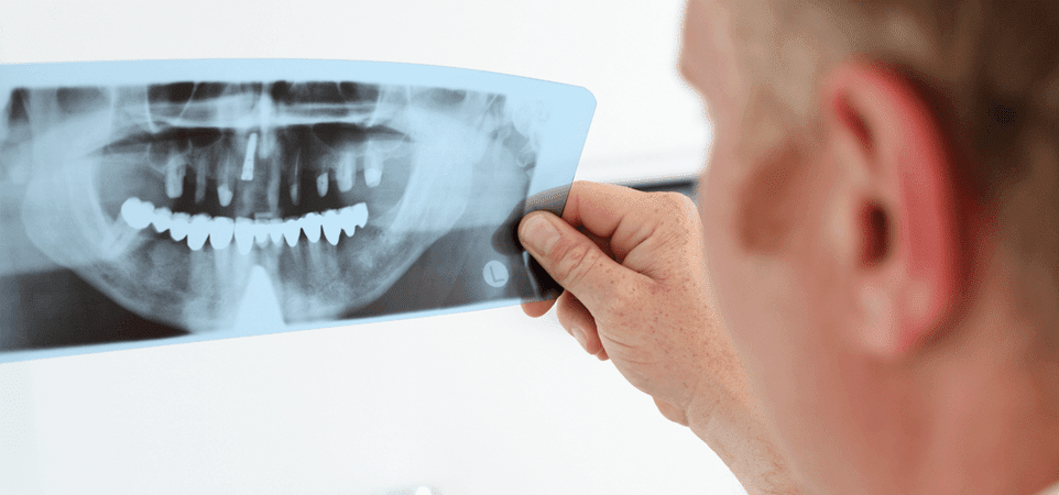 1413897205tabagismo post 1