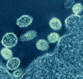 imagem do vírus h1n1 em laboratório visto através de um microscópio