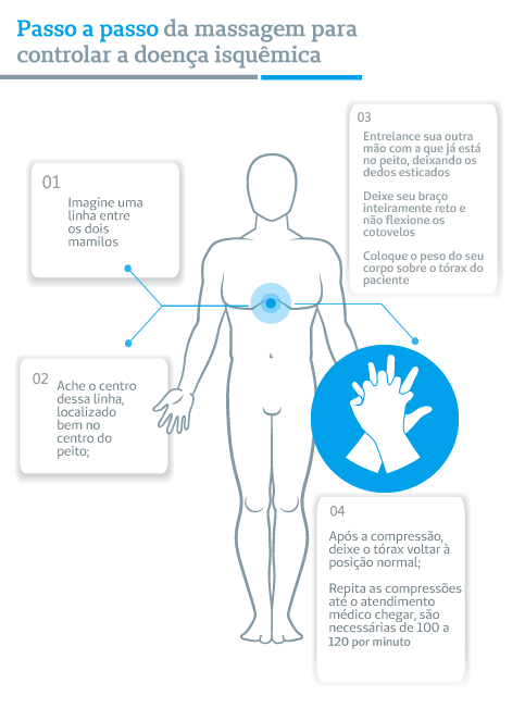 Infográfico de doenças isquêmicas
Passo a passo da massagem para controlar a doença isquêmica
1: Imagine uma linha entre os dois mamilos
2: Ache o centro dessa linha, localizado bem no centro do peito
3: Entrelace sua outra mão com a que já está no peito, deixando os dedos esticados
Deixe seu braço inteiramente reto e não flexione os cotovelos
Coloque o peso do seu corpo sobre o tórax do paciente
4 - Após a compressão, deixe o tórax voltar à normal; 
Repita as compressões até o atendimento médico chegar, são necessárias de 100 a 120 por minuto.
