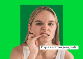 sorriso gengival