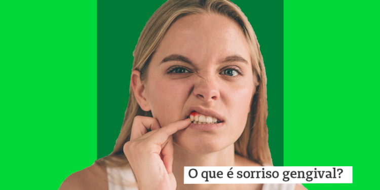 sorriso gengival