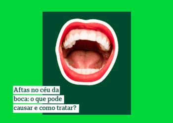 large afta ceu da boca