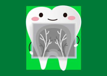 radiografia do dente