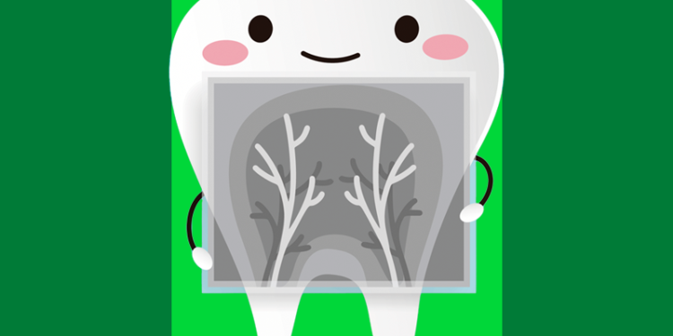radiografia do dente