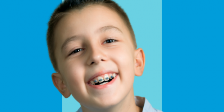 Moldura menor blog 800x600 1 1