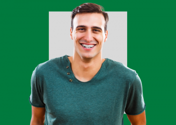 Aparelho autoligado o que e e para que serve 1