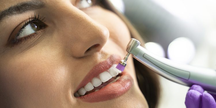 Polimento dental o que e e para o que serve scaled