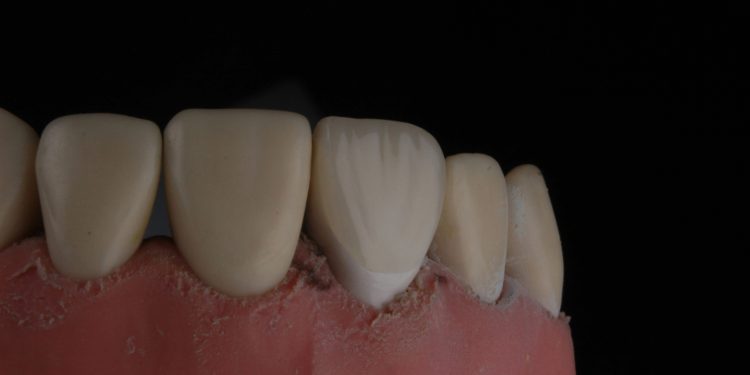 infeccao gengiva scaled