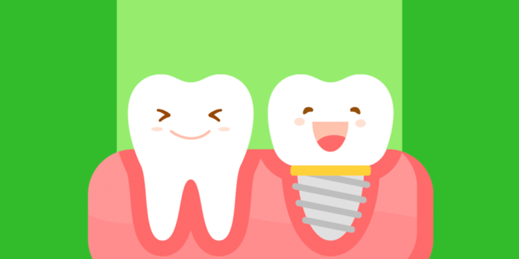 Ilustração: Dente com prótese