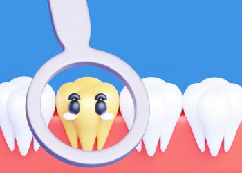 Ilustração do dente do siso em uma arcada dentária.