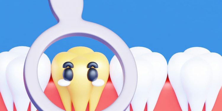 Ilustração do dente do siso em uma arcada dentária.