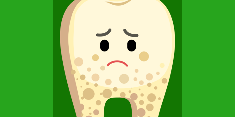 ilustração de dentinho com manchas marrons em sua base e com carinha de triste