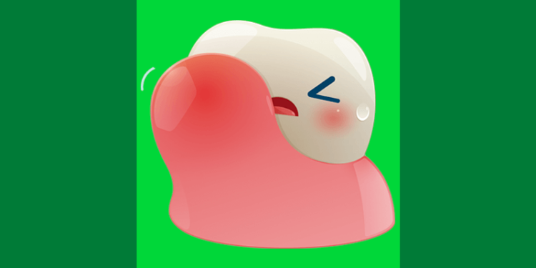 Ilustração mostra dente coberto pela gengiva indicando necessidade de cirurgia de gengivectomia