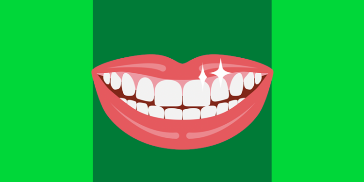 Boca sorrindo com dentes brilhando para o Dia Mundial da Saúde Bucal