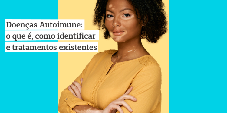 Mulher com vitiligo sorrindo para a imagem, com os braços cruzados na frente do peito. Na legenda está escrito "doenças autoimunes: o que é, como identificar e tratamentos existentes"