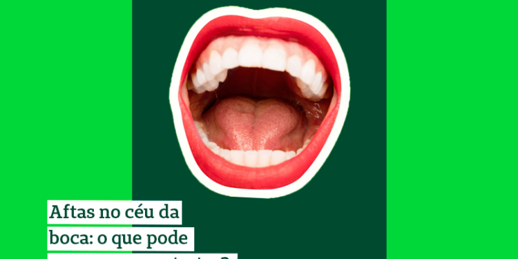 imagem de uma boca aberta mostrando os dentes e uma afta no céu da boca