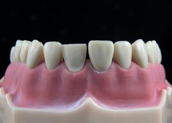 Prótese dentária com fundo preto.