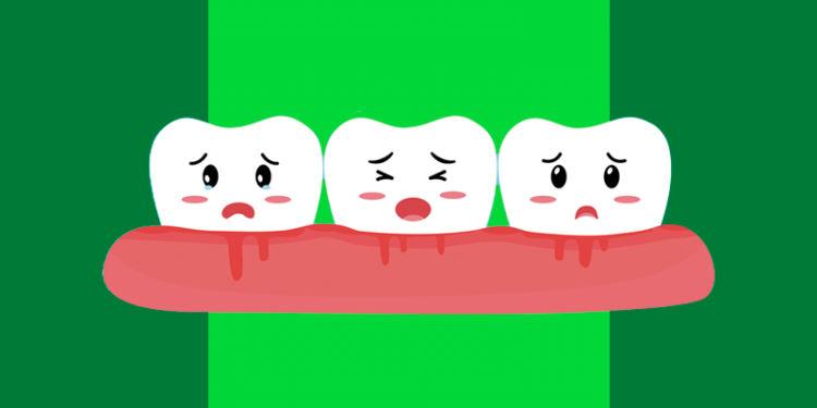 três dentinhos tristes em uma gengiva afetada por gengivite, capa do conteúdo sobre remédios caseiros para gengivite