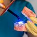 Um dentista segurando uma prótese dentária