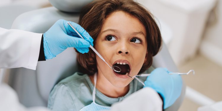 Quais os sintomas de uma cárie oculta? 6 dicas para tratar