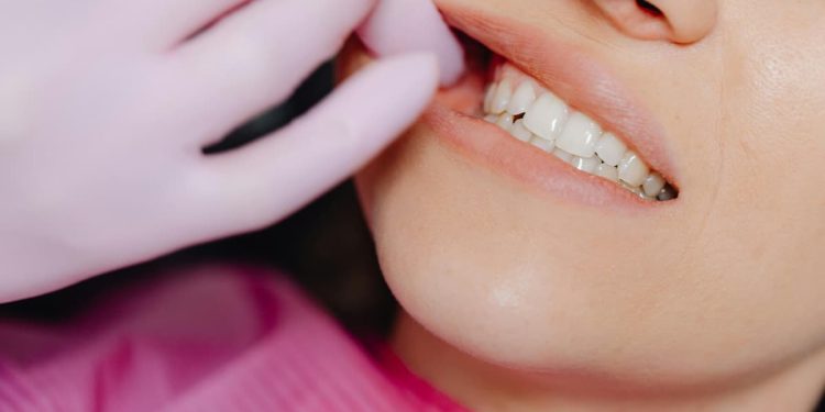 Mulher com gengiva vermelha exposta sendo avaliada por um dentista.