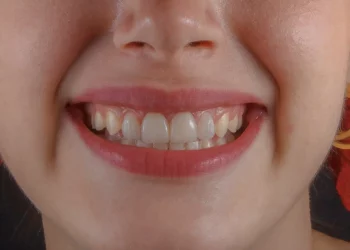 imagem de uma mulher sorrindo