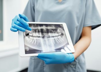 Dentista mostrando radiografia odontolológica.