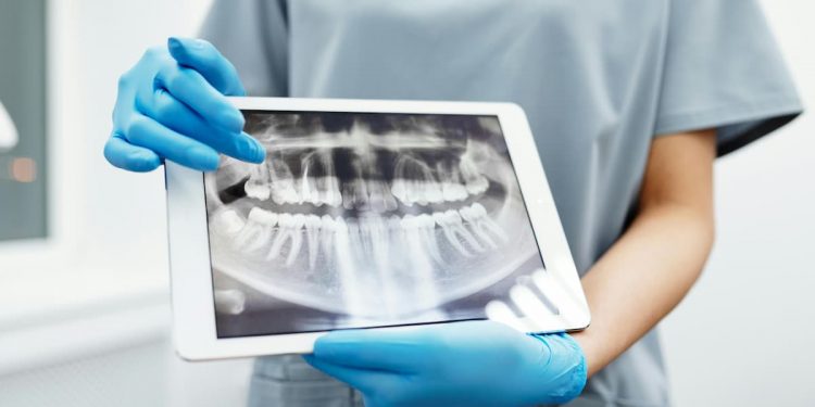 Dentista mostrando radiografia odontolológica.